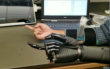 Researchers are developing new ultrasound technology for artificial hands.